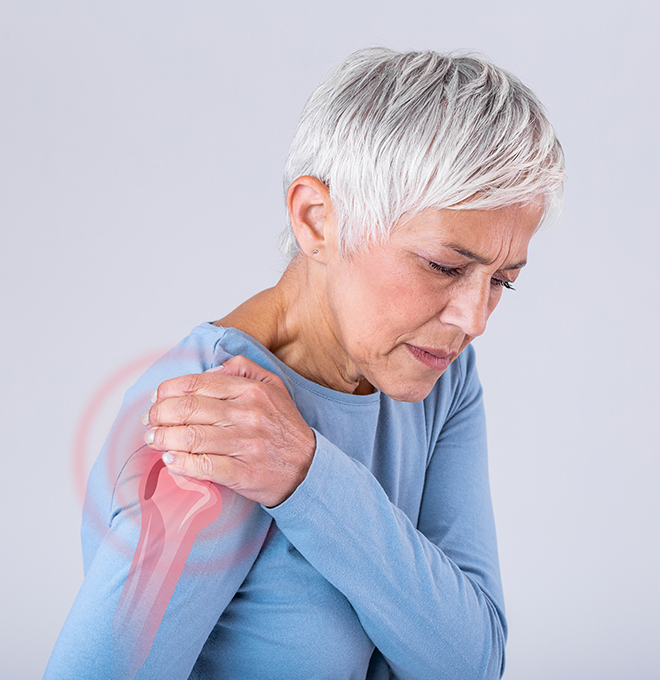 Osteoporosis And Bone Health KelseyCare Advantage Osteoporosis And Bone Health KelseyCare Advantage