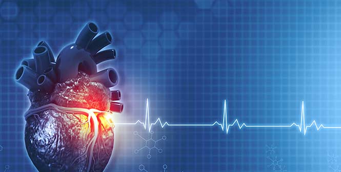 Vascular Screenings